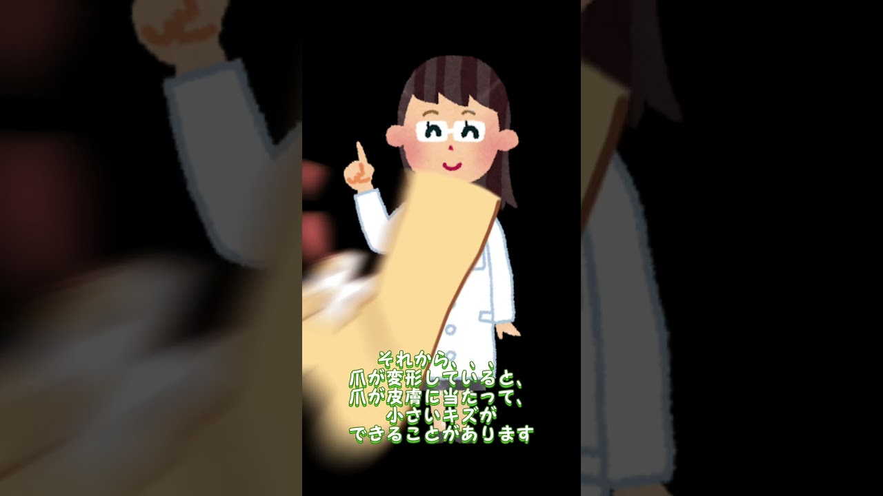 爪水虫、放っておくと？#爪水虫 #爪白癬 #放置 #無治療 #無治療を選択 #水虫 #白癬 #蜂窩織炎 #寝たきり #炎症 #足 #爪変形 #爪変色 #皮膚科 #美容皮膚科 #こはく皮フ科クリニック